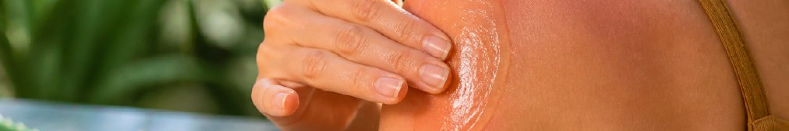 aloe-vera-gel-til-solskoldning-sadan-virker-det-1788572533-3